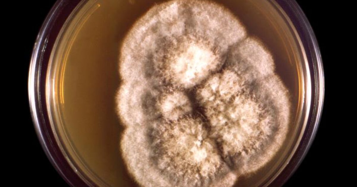 Authentic public-domain CDC laboratory image of Coccidioides immitis, the soil fungus associated with Valley fever
